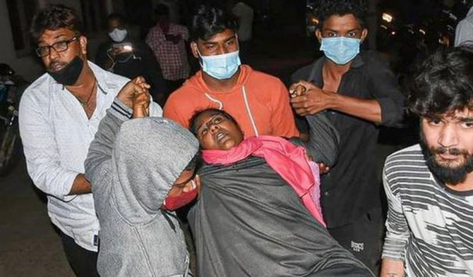 Salah seorang penderita penyakit aneh di Andhra Pradesh, India Selatan /ist