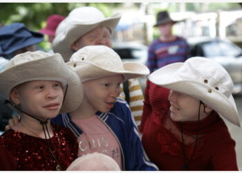 Orang-orang yang menderita albinisme berkumpul dalam sebuah acara untuk memperingati Hari Kesadaran Albinisme Internasional di Dar es Salaam, Tanzania, pada 13 Juni 2021. Pemerintah Tanzania pada Minggu (13/6) menjanjikan perlindungan penuh bagi penderita albinisme dengan memperkuat keamanan mereka. Hari Kesadaran Albinisme Internasional dirayakan setiap tahun pada 13 Juni. Tahun ini, hari tersebut mengusung tema "Kekuatan Melampaui Segala Rintangan". (Xinhua/Herman Emmanuel)
