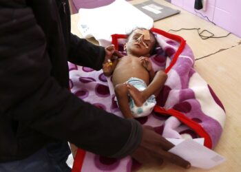 Seorang ayah membawa anaknya yang menderita kekurangan gizi untuk ditimbang ketika menerima perawatan medis di bangsal perawatan malnutrisi di sebuah rumah sakit di Sanaa, Yaman, pada 13 Maret 2022. (Xinhua/Mohammed Mohammed)
