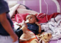 SANAA, Seorang anak yang menderita malanutrisi dirawat di sebuah rumah sakit di Sanaa, Yaman, pada 29 Mei 2023. (Xinhua/Mohammed Mohammed)